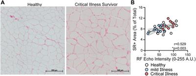 Construct and criterion validity of muscle ultrasonography for assessment of skeletal muscle in patients recovering from COVID-19